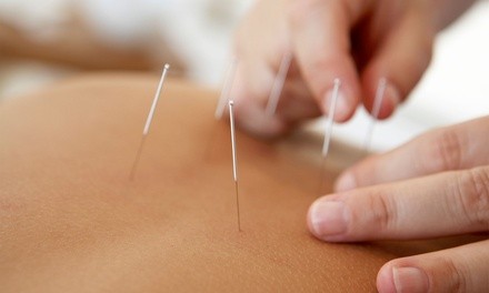 Initial Consultation and Dry Needling Session at Elite Chiropractic (Up to 84% Off). Two Options Available.