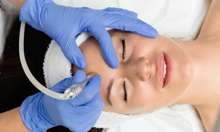 One or Two Diamond Microdermabrasion Treatments at Skin Essence (Up to 61% Off)