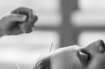 Up to 63% Off on Acupuncture Services at Point Prescription