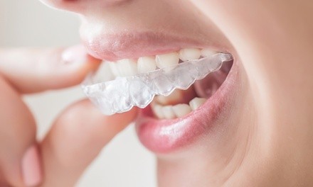 Dental Package or $1,000 Toward Invisalign or Veneers at Thomas L. Anderson DDS & Associates