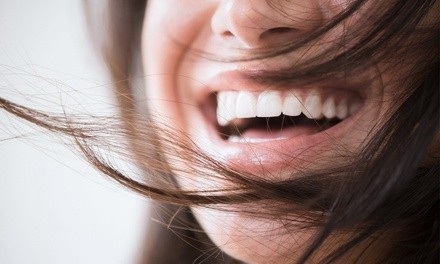 $36.75 for One BleachBright Teeth Whitening Session at Cryo Myst Therapy Lounge ($79 Value)