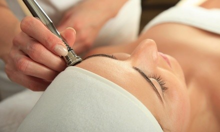 30- or 60-Minute Microdermabrasion Treatment with Add-Ons at GlamIndia Threading and Spa (Up to 59% Off)