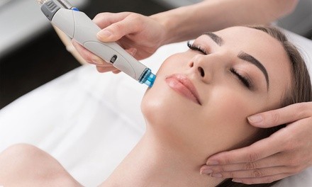 One or Three Microdermabrasion Treatments at Bogo Tanning & Cryo (Up to 75% Off)