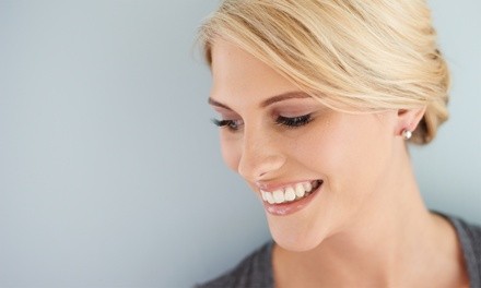 $107 for One 60-Minute In-Office UV Cosmetic Teeth-Whitening Treatment at Blue Mermaid Spa ($165 Value)