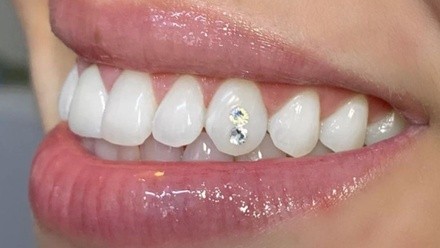 One or Two Swarovski Crystal Tooth Gems for One Person at Sudden Gleam (Up to 25% Off)