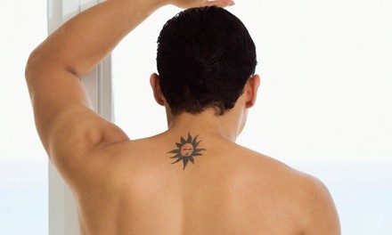 Three Tattoo-Removal Sessions on 2x2-, 3x4-, 4x4-, or 6x6-Inch Area at The Ferguson Clinic (Up to 80% Off)