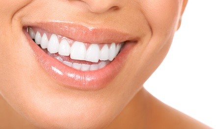 Dental Exam, Cleaning, and X-ray with Optional Zoom! Whitening Treatment at Nazanin Ezzati DDS (Up to 89% Off)