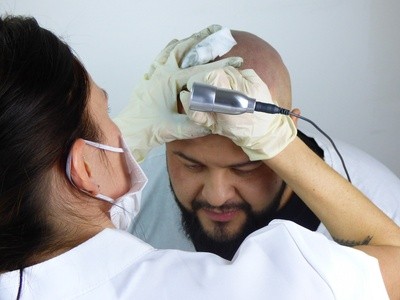 Up to 65% Off on Hair Restoration - Other at America Scalp Micropigmentation
