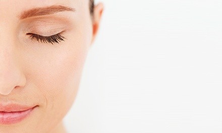 One or Three Microdermabrasion Sessions at Newport Body Sculpting (Up to 39% Off)