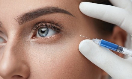 $169 for 20 Units of Botox at Rejuvenature Medical ($260 Value)