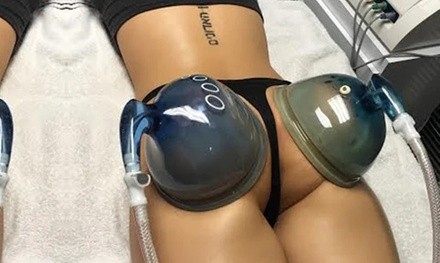 One Non-Surgical Brazilian Butt Lift with Optional LED Light Therapy at S.M. Enhancements (Up to 35% Off)