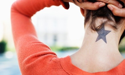 PicoSure Tattoo-Removal Sessions for Small, Medium, or Large Area at Defining Beauty (71% Off)