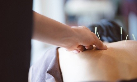 One or Two Acupuncture Sessions at Longevity Acupuncture Clinic (Up to 59% Off)