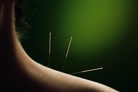 Up to 66% Off accupuncture at IKA Acupuncture Clinic Oriental Medicine LLC