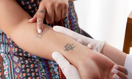 One or Three Tattoo-Removal Sessions at Luxury Med Spa at Luxury Med Spa (Up to 88% Off). 15 Options Available.