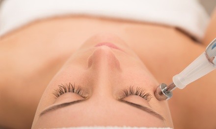 One or Two Microdermabrasion Treatments at Suburban Medspa (Up to 70% Off)