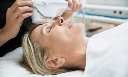 One or Three Radio-Frequency Facials at Skin & Body By Jasmine (Up to 58% Off)