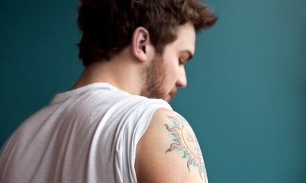Three Laser Tattoo-Removal Treatments for an Area Up to 4