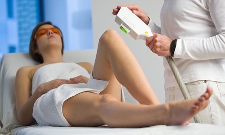 One or Three Laser Hair Removal Treatments at BodyBrite (Up to 70% Off)