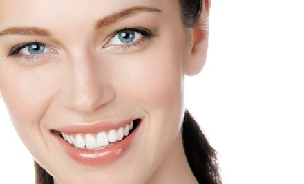 $57 for Teeth Whitening at MicroSpa ($99 Value)