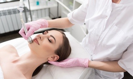 Chemical Peel, or Microdermabrasion with HydraFacial or Chemical Peel at BE Salon and Spa (Up to 60% Off)