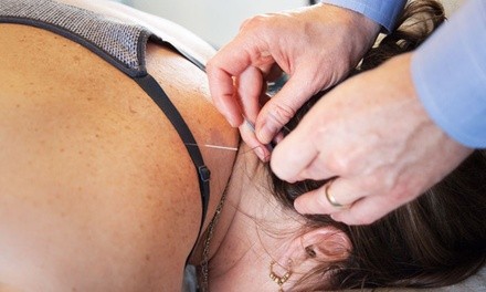 One, Three, or Five Acupuncture Packages with Heat Lamp Therapy and Massages from Ross McCallum (Up to 60% Off) 