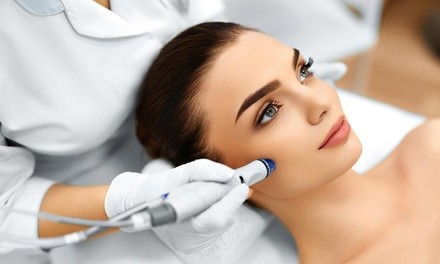 One, Three, or Five Microdermabrasion Facial Treatments at Essentials Laser & Med Spa (Up to 64% Off)