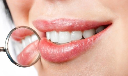 Dental Cleaning, Exam, and X-Rays or Teeth Whitening at Highland Village Dental Studio (Up to 72% Off)