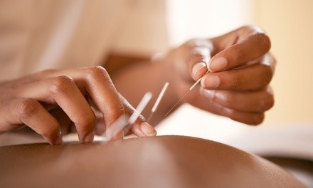 One or Three 60-Minute Acupuncture Sessions with Consultation at Dragonfly Acupuncture (Up to 48% Off)