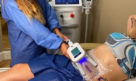 One or Two CryoSculpt Sessions at Lavande Spa (Up to 36% Off)