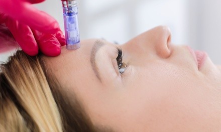 One, Two, or Three Microneedling Sessions at Wild & Beautiful (Up to 70% Off)