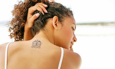 Tattoo Removal from Shahin Javaheri, MD Advanced Aesthetic, Plastic & Reconstructive Surgery (78% Off)