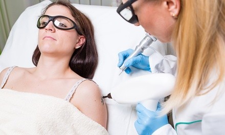 PicoWay Laser Tattoo-Removal Session on an Area Up to Four or Nine Square Inches at Laser Duet (Up to 83% Off)