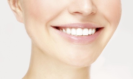 $60.50 for Dental Exam with Bleaching Kit at Medident