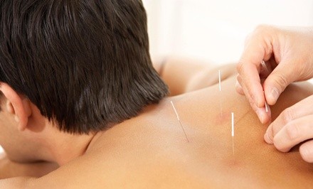 $68 Off $139 Worth of Acupuncture