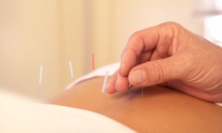 Consultation with One or Two Acupuncture Sessions at Albatross Physical Therapy And Wellness (Up to 61% Off)