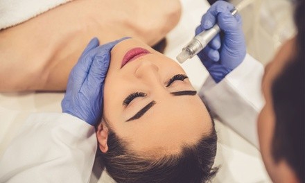 One or Two Medical Microneedling Facials at Terra Medspa (Up to 64% Off)