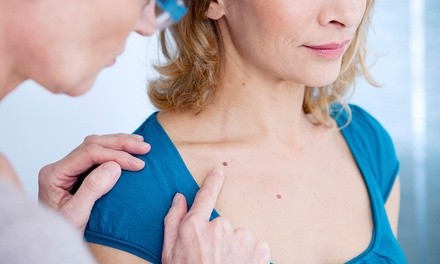 One, Two, or Three Skin Tag or Spot Removals with Lauren at The Body Spa (Up to 67% Off) 