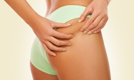 One or Two Lipomassage Cellulite Reduction Treatments at Terra Salon and Spa (Up to 72% Off)