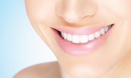 $31.20 for Teeth Whitening Kit and $1200 Towards a Full Invisalign Treatment from Dr. Roger A. Flake, DDS 