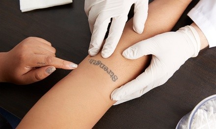 Two Laser Tattoo-Removal Sessions on Area up to 3, 5, or 8 Square Inches at WISE Medical Centers (Up to 83% Off)