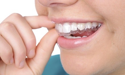 Invisalign Package at Randhawa Dentistry (Up to 96% Off). Two Options Available