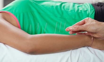 Up to 66% Off on Acupuncture Services at Golden Health And Beauty Center