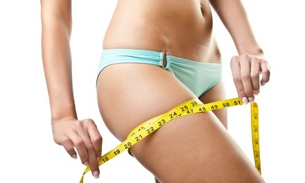 2, 6, or 10 Synergie and Microcurrent Cellulite-Reduction Treatments at Aesthetics For You (Up to 67% Off)