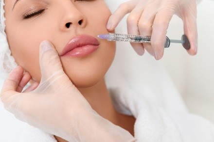 $403.06 for One 1.5cc Syringe of Radiesse Filler at Botox It ($650 Value)