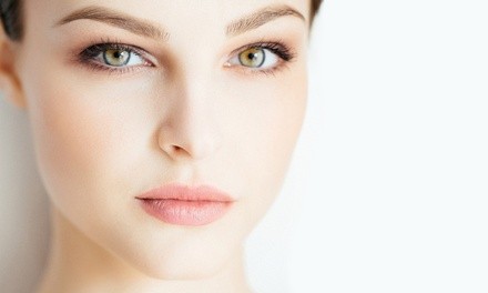 $523.50 for One Syringe of Restylane at Luna Vision and Laser ($1,000 Value)