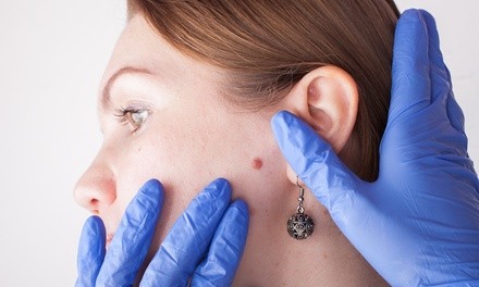 Skin Tag Removal for One or Three Spots at The Holistic Bar (Up to 36% Off)