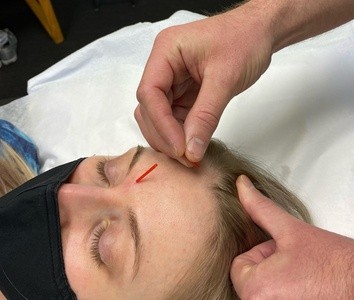 Up to 50% Off on Acupuncture Services at Labash Wellness Center