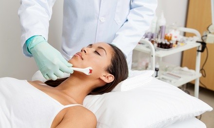 $70 for One Microneedling Session at Honey Brows ($100 Value)