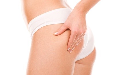 Four or Six Non-Surgical Brazilian Butt Lift Sessions at Body Face Image Solutions (Up to 73% Off)